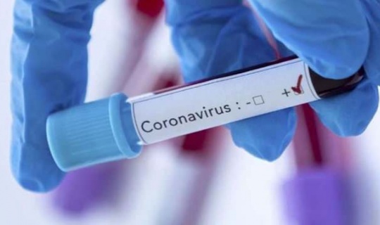 Koronavirüs vaka sayımız 18