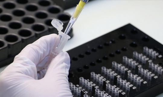 Aşı olmayan işçilerden PCR istenebilecek