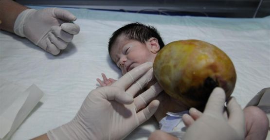 Nur Bebeğin Organları Kesesinde